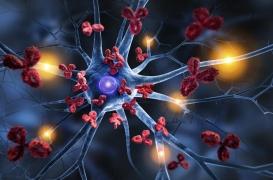 Qu'est-ce que le syndrome VEXAS, une maladie qui touche de nombreux patients ?