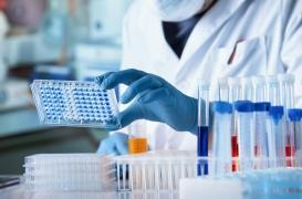 Cerveau : étudier 10 ans de maladie d'Alzheimer en seulement 42 jours