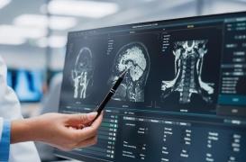 Lésions cérébrales : cette protéine joue un rôle clé dans la guérison