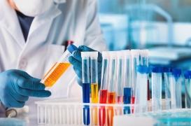 Cancer du pancréas : le rôle clé d’une protéine dans la croissance tumorale a été identifié