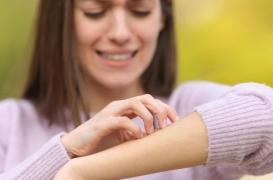 Bouton de moustique : les solutions naturelles pour calmer les démangeaisons