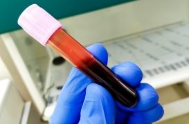 Cancer de l'ovaire : un test sanguin pourrait aider à le détecter plus tôt  