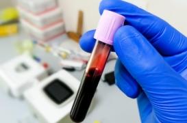 Cancers silencieux : un nouveau test sanguin pourrait les détecter de façon précoce