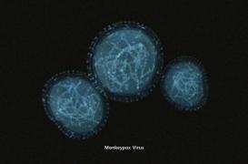 Variole du singe : les cas recensés pourraient n'être que 