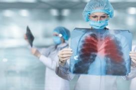 Une pneumonie d’origine inconnue cause le décès de trois personnes en Argentine