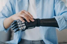 Après une amputation, le corps n'oublie pas le membre perdu