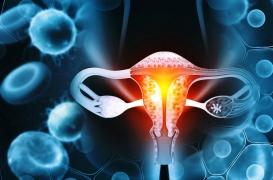 Retirer les lésions du col de l'utérus réduit les risques de cancer