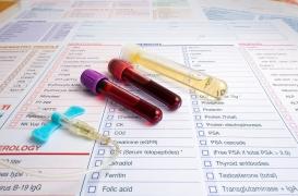 Insuffisance rénale : des biomarqueurs découverts dans le sang et l'urine