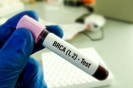 Une mutation génétique associée à 3 cancers proviendrait d'une famille écossaise du 18ème siècle