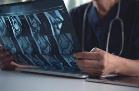 Myostéatose : avoir plus de graisses dans les muscles augmente le risque de décès 