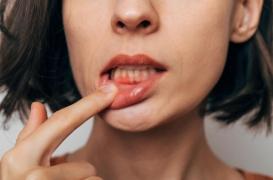 Parodontite : ce thé japonais peut réduire vos risques 