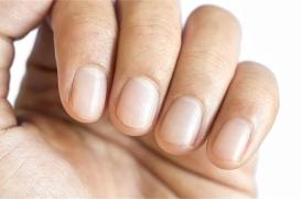Endocardite : l’état de vos ongles peut alerter sur la maladie