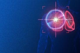 Cancer : l’IA peut-elle aider à vaincre les tumeurs 