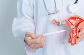 SOPK : vers des traitements plus ciblés contre le dysfonctionnement endométrial ? 