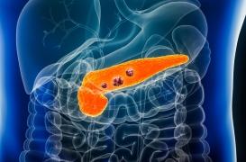 Cancer du pancréas : découverte d’une nouvelle protéine cible de traitement
