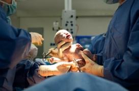 Il est possible d’accoucher normalement après une césarienne mais on ne vous le dit pas toujours