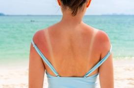 “Burn lines” : attention à cette tendance qui circule sur les réseaux sociaux