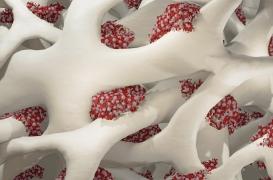 Mastocytose systémique : reconnaître et comprendre cette maladie rare