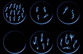 Stress : quels sont ses effets sur la qualité du sperme ?