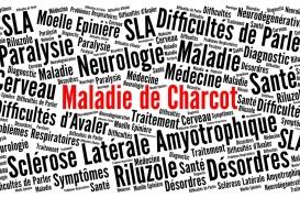 Maladie de Charcot : ce nouveau biomarqueur prédit l’évolution de la SLA