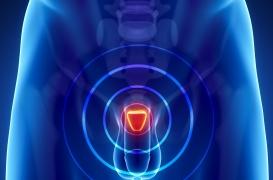 L’IRM plus efficace que la biopsie dans le diagnostic du cancer de la prostate