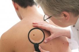Cancer de la peau : le dépistage précoce augmente les chances de survie