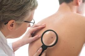 Pour éviter un cancer grave, il faut surveiller les taches sur la peau