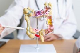Cancer colorectal : attention aux selles fines, un signe avant-coureur inattendu !