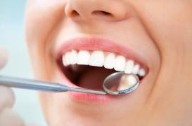 Parodontite : la  maladie des gencives pourrait être à l'origine de la maladie d’Alzheimer