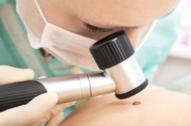 Cancer de la peau : il en existe trois types différents