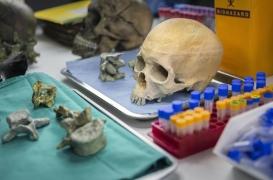 L'ADN de nos ancêtres nous en dit plus sur nos maladies actuelles