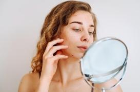 Eczéma : « les nouveaux traitements sont vraiment intéressants »