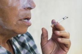 Cancer de la bouche : l’importance du nombre de ganglions atteints est fortement prédictive