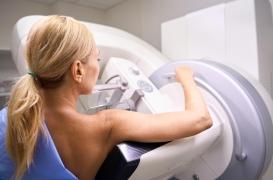 Cancer du sein : un ancien mannequin explique pourquoi elle a refusé la chimiothérapie