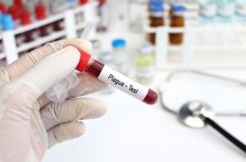 Peste pulmonaire : un premier cas mortel depuis près de 20 ans en Arizona 