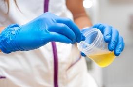 Les troubles mentaux laissent-ils des traces dans l’urine ?