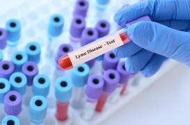Maladie de Lyme : vers un meilleur diagnostic ? 