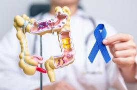 Cancer colorectal : la hausse des cas chez les jeunes enfin expliquée ?