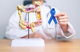 Cancers gastro-intestinaux : le nombre de cas devrait doubler d'ici 2050