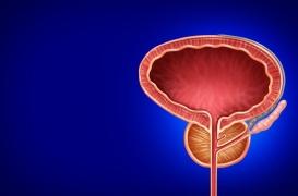 Cancer de la prostate : des dépistages à interpréter avec prudence chez les femmes transgenres