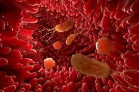 Cancer colorectal, obésité : un déséquilibre du microbiote en cause