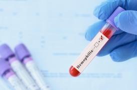 Hémophilie : un nouveau traitement déployé au CHU de Nantes