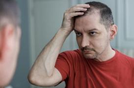 Alopécie : la médecine chinoise peut-elle vous rendre vos cheveux ?