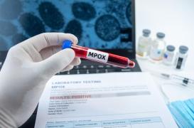 Mpox à La Réunion : la vigilance s’intensifie après deux nouveaux cas
