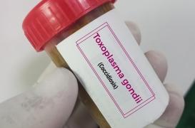 Cette infection oculaire touche un tiers de la population mondiale 