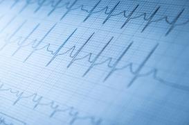 Complications chirurgicales : l’IA peut mieux les prédire que les médecins ? 