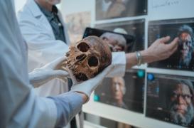 Maux de tête, douleurs cervicales, vertiges… Et si c’était un héritage de Néandertal ?