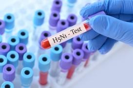 La grippe aviaire pourrait-elle déclencher une nouvelle pandémie ?