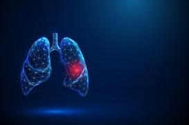 Cancer du poumon : ces infections courantes pourraient augmenter les risques