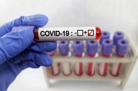 Covid-19 : quels sont les symptômes du variant 
